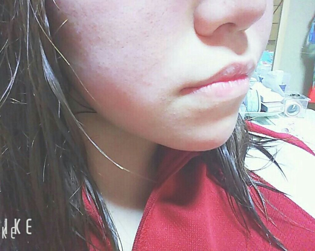 薬用 雪肌精/雪肌精/化粧水を使ったクチコミ(2枚目)