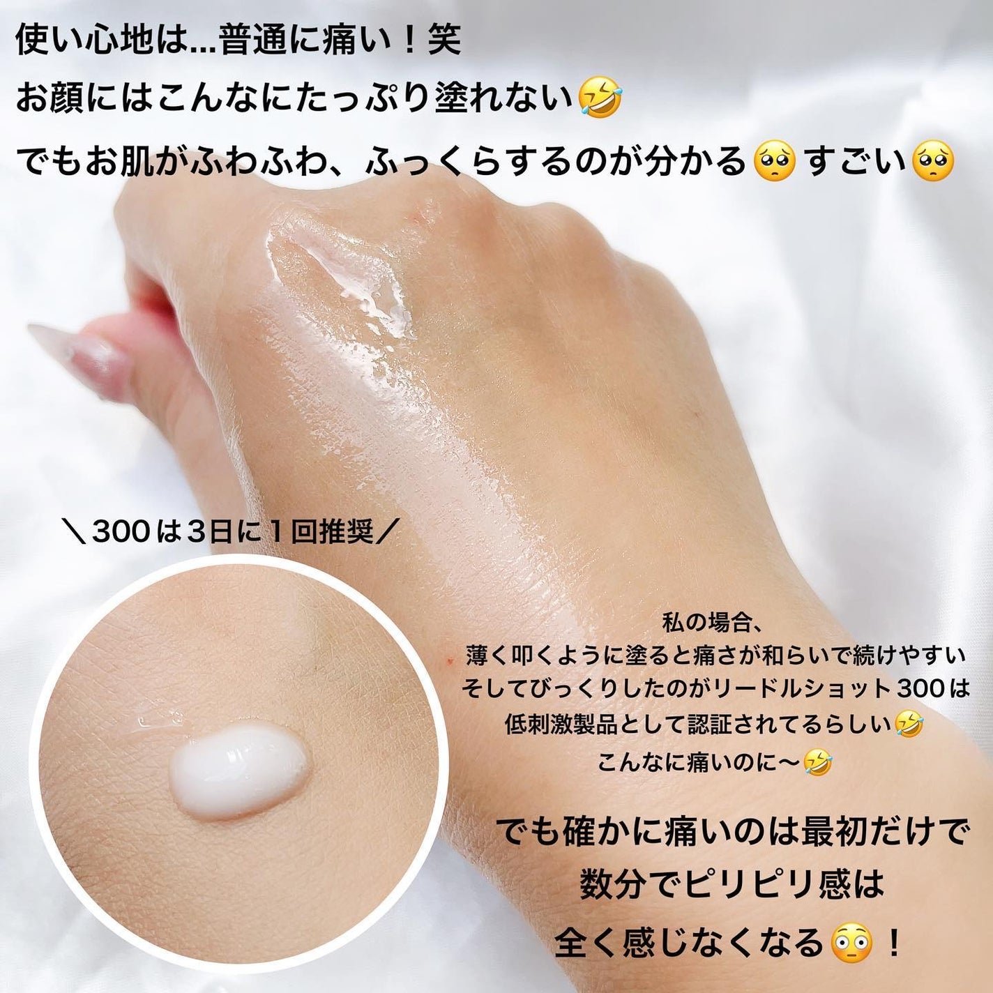 リードルショット300/VT/美容液を使ったクチコミ(4枚目)