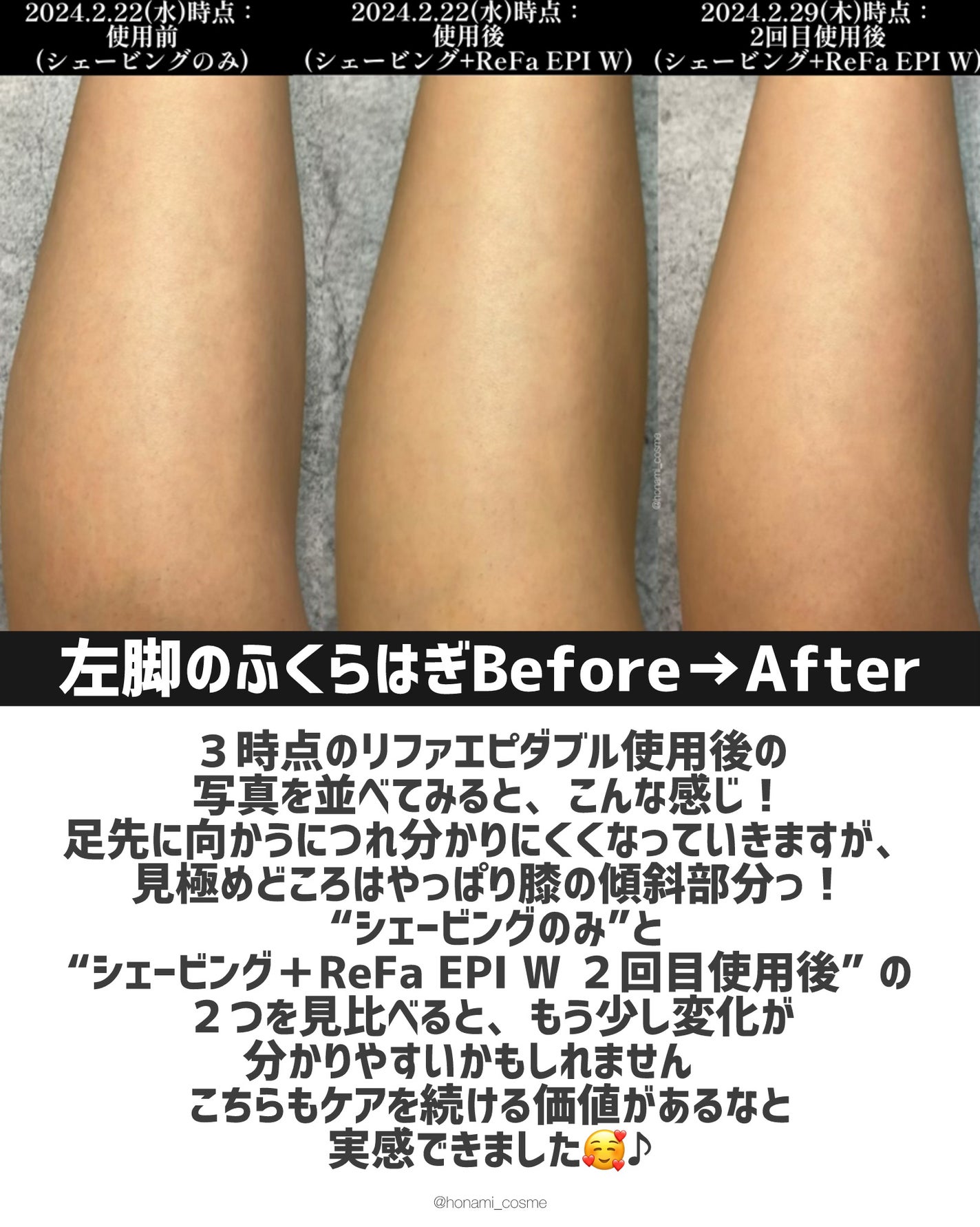 ReFa EPI W/ReFa/ボディケア美容家電を使ったクチコミ(8枚目)