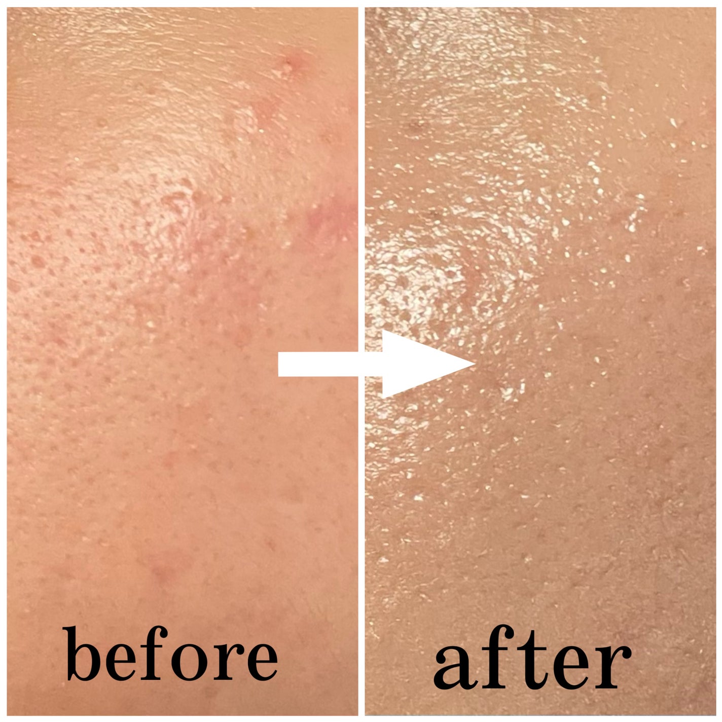 フィーファンデーションガラス/fwee/リキッドファンデーションを使ったクチコミ(2枚目)