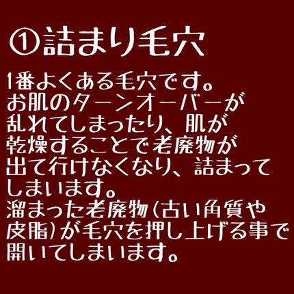 リアルカレンデュラピールオフパック/APRILSKIN/ピーリングを使ったクチコミ(2枚目)