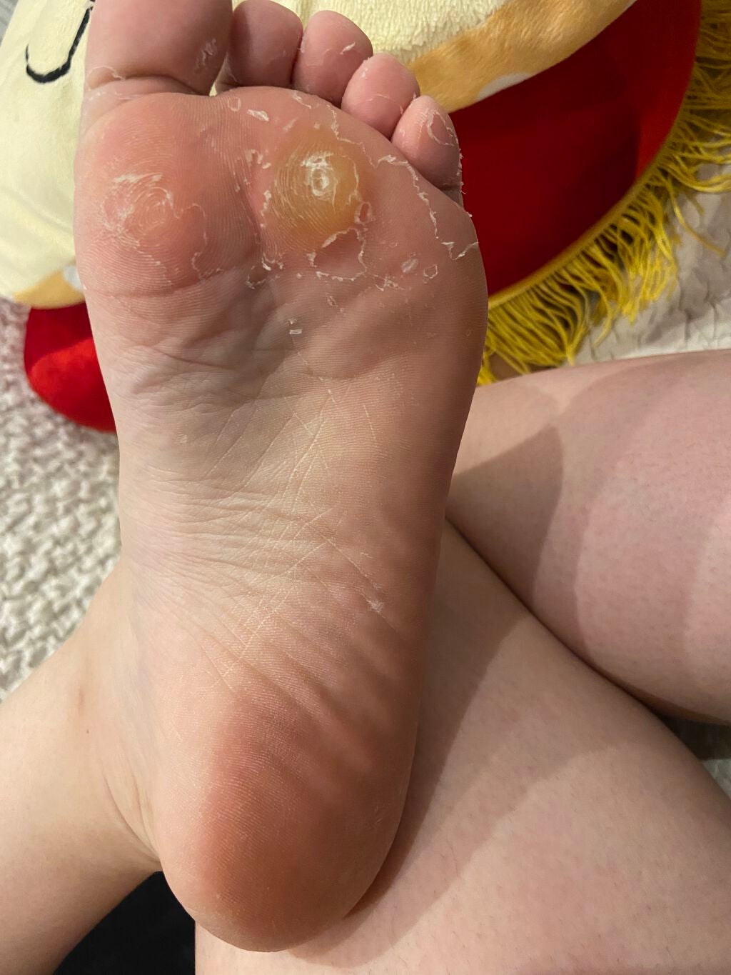 美容液から生まれた足裏角質ケア/スムースアウェイ/レッグ・フットケアを使ったクチコミ(2枚目)