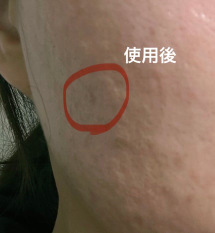 アイレノールすっぴんクリーム/IRENOL/クリームコンシーラーを使ったクチコミ(4枚目)