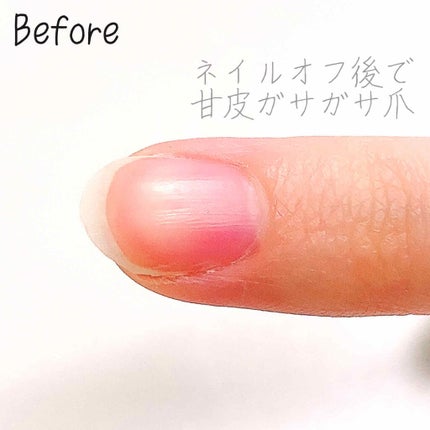 ネイルリラクシングオイル/デュカート/ネイルオイル・トリートメントを使ったクチコミ(3枚目)