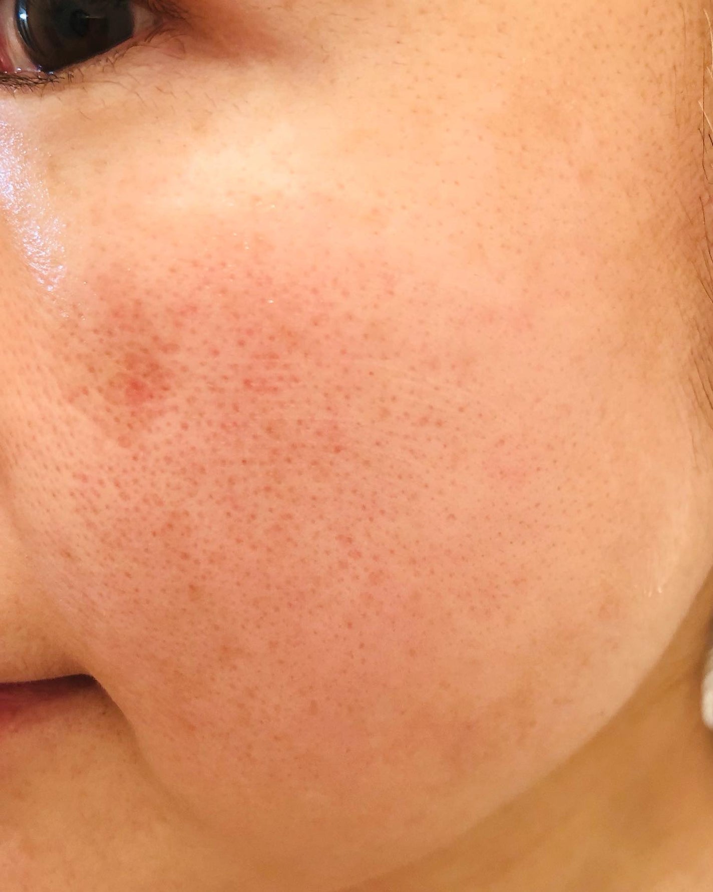 メープルエナジーインフュージングセラム/Klairs/美容液を使ったクチコミ(7枚目)