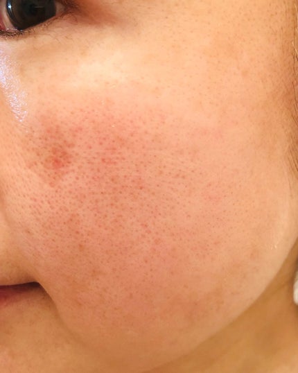 メープルエナジーインフュージングセラム/Klairs/美容液を使ったクチコミ(7枚目)