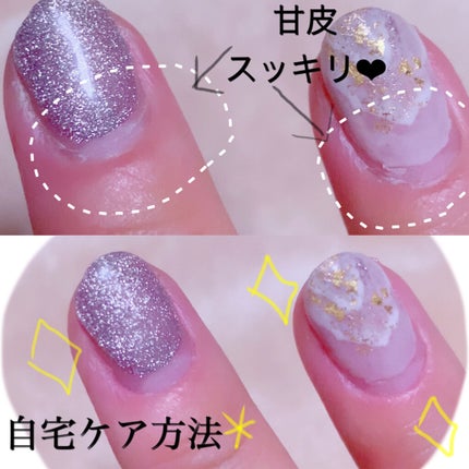 pa ニッパー/pa nail collective/その他スキンケアグッズを使ったクチコミ(1枚目)