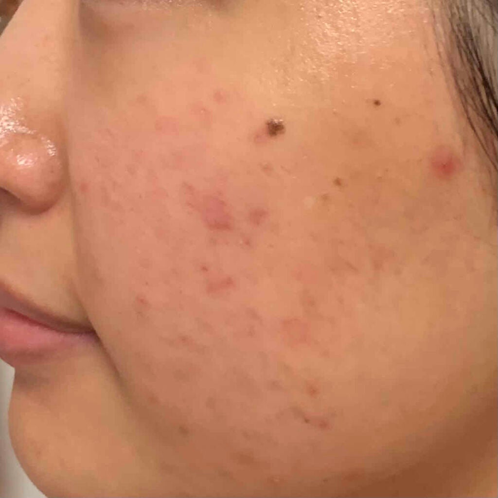 薬用 クリアローション M(しっとりタイプ)/オルビス/化粧水を使ったクチコミ(1枚目)