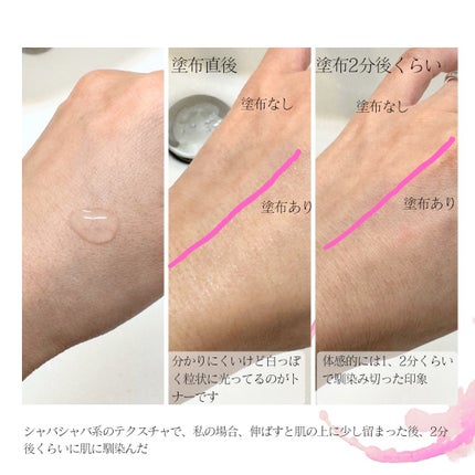 ピンクティーツリートナー/APLIN/化粧水を使ったクチコミ(4枚目)