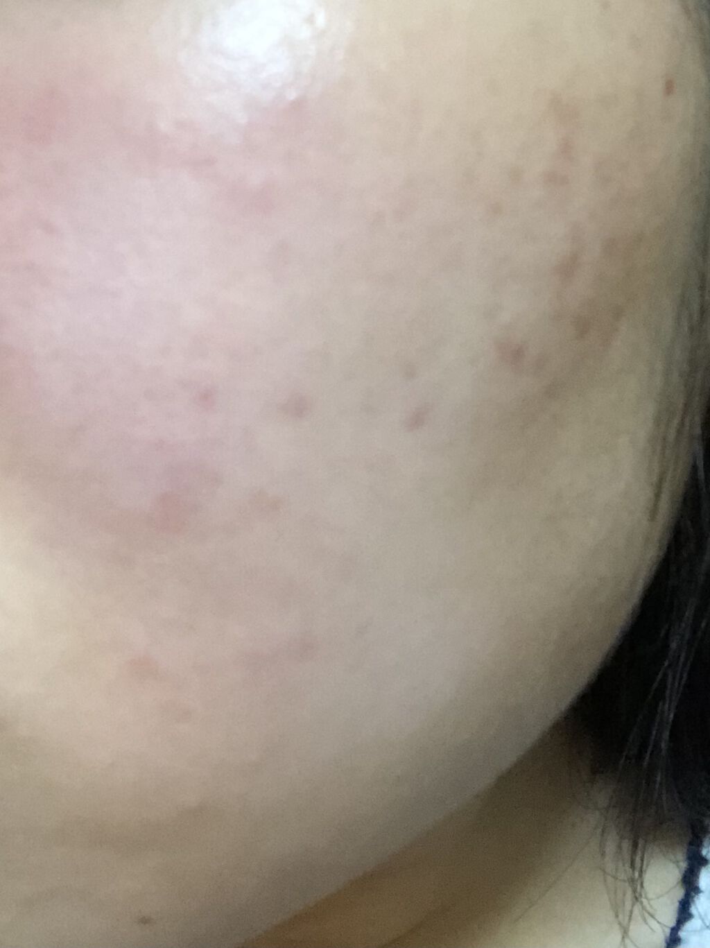 ハトムギ化粧水(ナチュリエ スキンコンディショナー R )/ナチュリエ/化粧水を使ったクチコミ（3枚目）