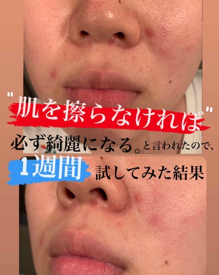 を使ったクチコミ(1枚目)