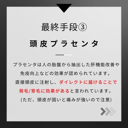 ヨウ | 31歳の老けない暮らし on LIPS 「今回は薄毛対策の最終手段を紹介します。薄毛に悩んでいる方、実は..」(5枚目)