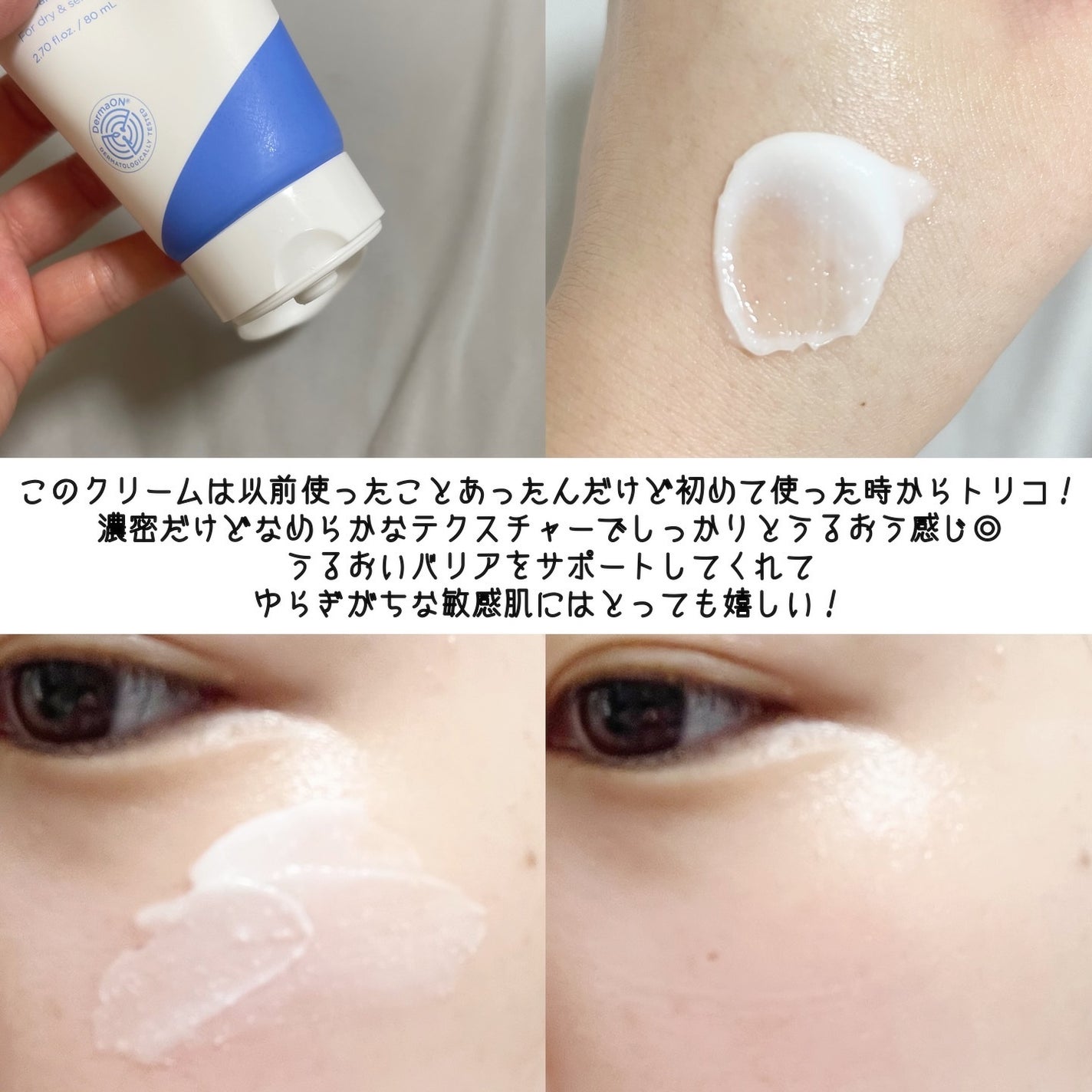 アトバリア365クリーム/AESTURA/フェイスクリームを使ったクチコミ(7枚目)