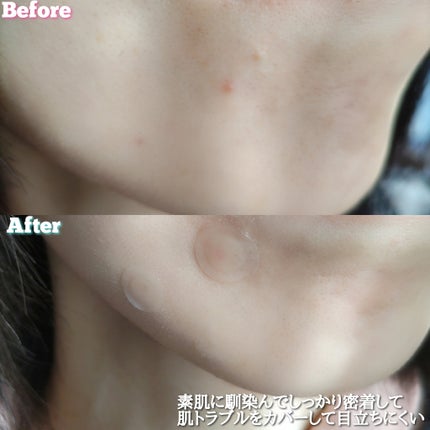 キャッチミーパッチ/CATCH ME PATCH/にきびパッチを使ったクチコミ(6枚目)