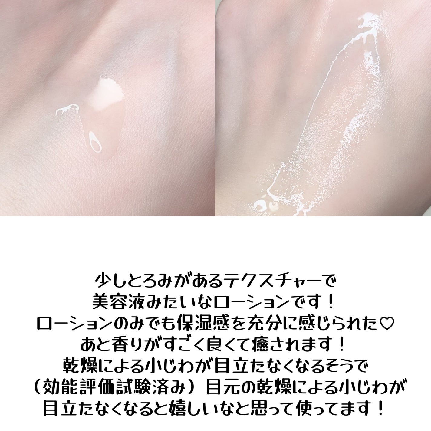 オイデルミン エッセンスローション/SHISEIDO/化粧水を使ったクチコミ(3枚目)