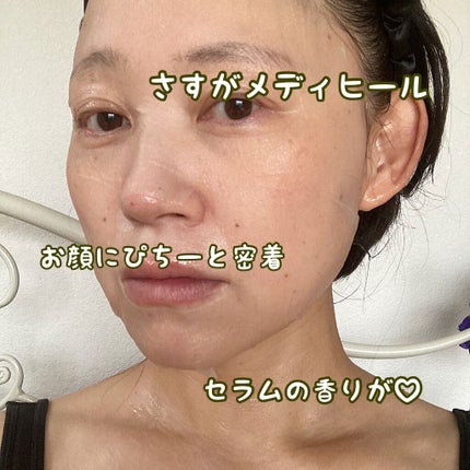 シカ ケア スージング マスク/MEDIHEAL/シートマスク・パックを使ったクチコミ(5枚目)