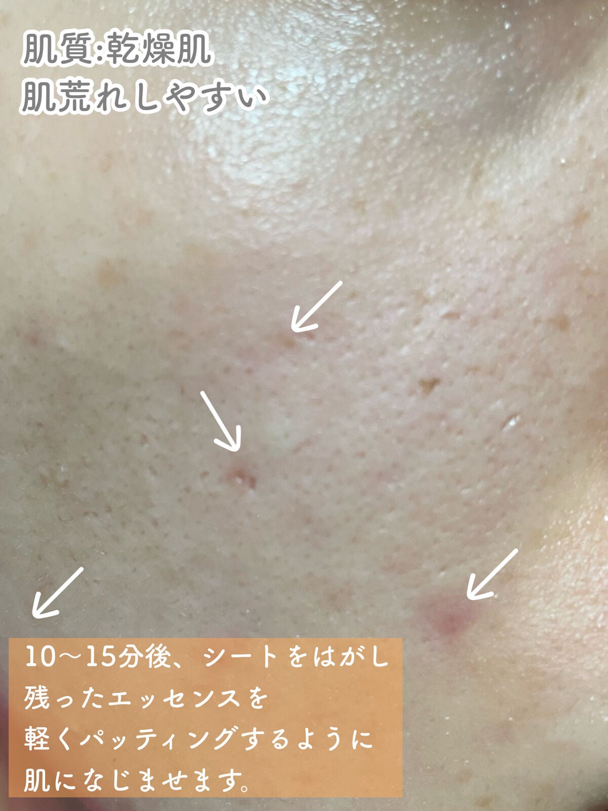 ルミナスマスク (ケアクリーム付き) /cerXcer/シートマスク・パックを使ったクチコミ(4枚目)