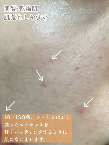 ルミナスマスク (ケアクリーム付き) /cerXcer/シートマスク・パックを使ったクチコミ(4枚目)