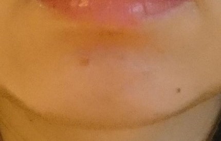 イハダ 薬用バーム【医薬部外品】/IHADA/フェイスバームを使ったクチコミ(3枚目)