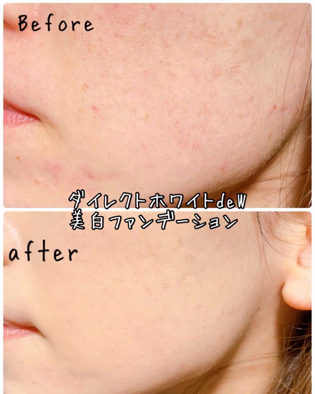 ダイレクトホワイトdeW 美白ファンデーション/pdc/化粧下地を使ったクチコミ（3枚目）