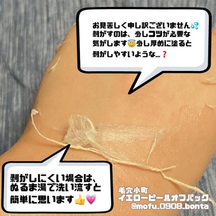 毛穴小町 ブラックピールオフパック/クリアターン/ピーリングを使ったクチコミ(5枚目)