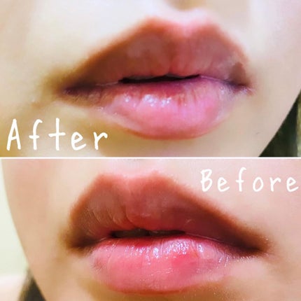 ディオール アディクト リップ マキシマイザー セラム/Dior/リップ美容液を使ったクチコミ(5枚目)