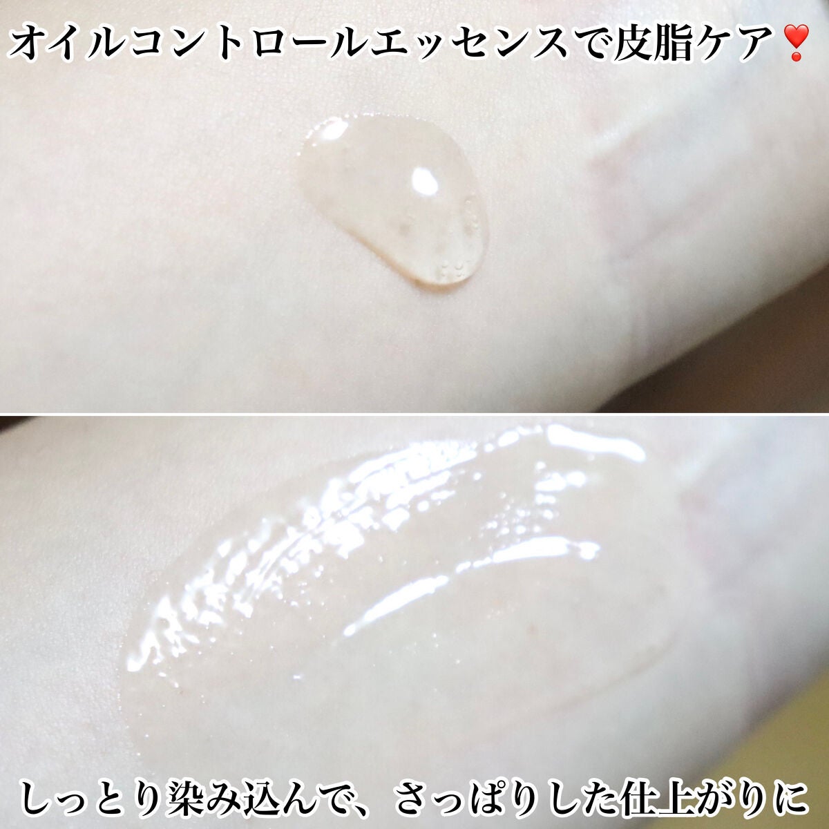 オイルコントロールカプセルエッセンス/celimax/美容液を使ったクチコミ(6枚目)