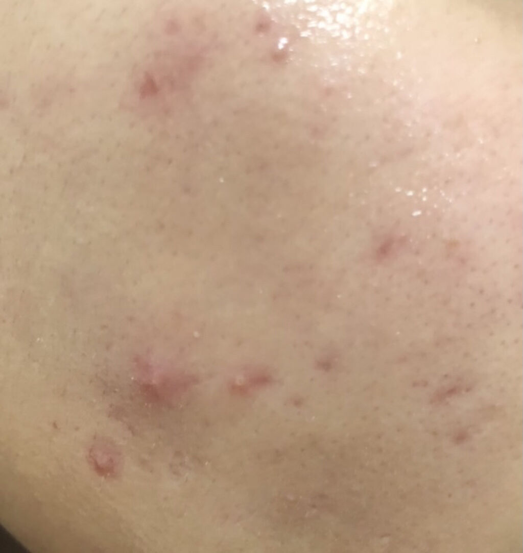 ヘデラヘリックス バランスクリーム/Milk Touch/フェイスクリームを使ったクチコミ（3枚目）