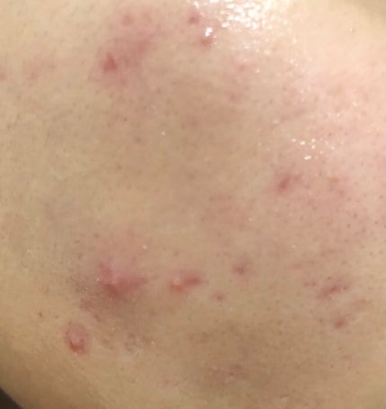 ヘデラヘリックス バランスクリーム/Milk Touch/フェイスクリームを使ったクチコミ(3枚目)