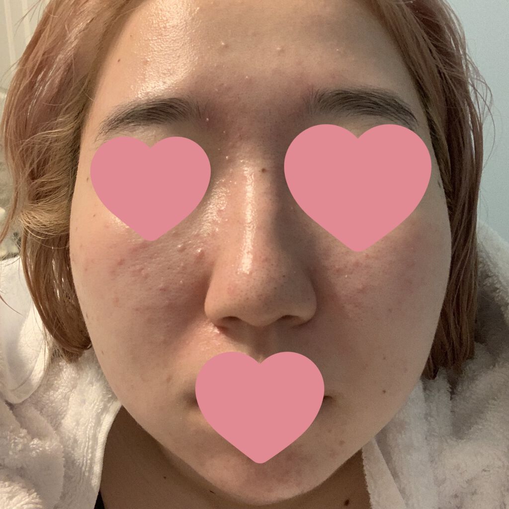 デュオ ザ クレンジングバーム ブラック/DUO/クレンジングバームを使ったクチコミ（2枚目）