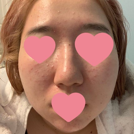 ハトムギ化粧水(ナチュリエ スキンコンディショナー R )/ナチュリエ/化粧水を使ったクチコミ(2枚目)