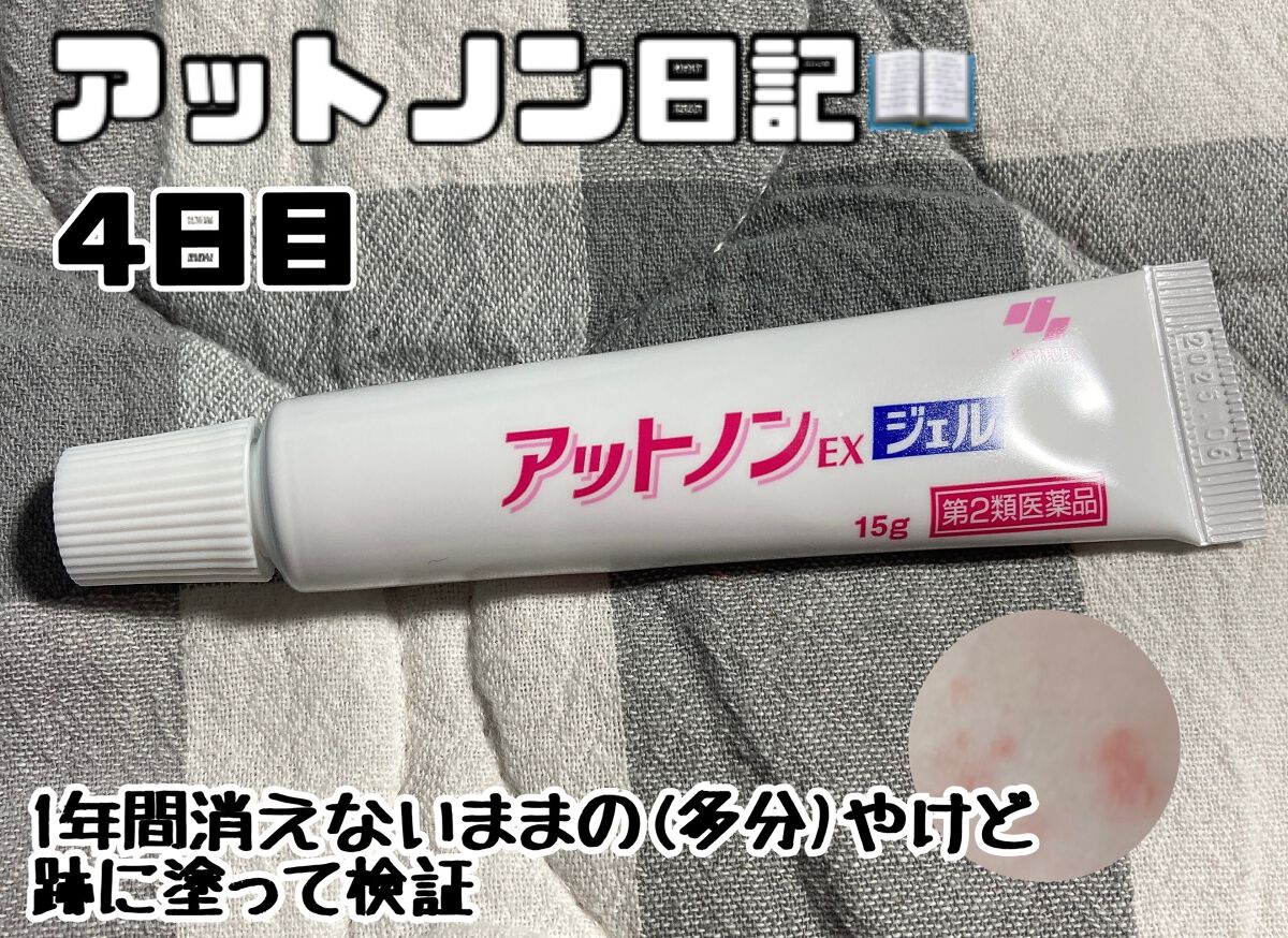 アットノンEX ジェル(医薬品)/アットノン/その他を使ったクチコミ(1枚目)