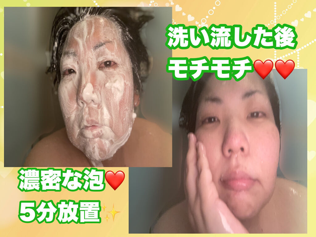 オーガニック炭酸ホワイトパック/Sing/洗い流すパック・マスクを使ったクチコミ（2枚目）