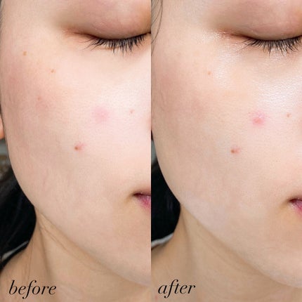 もち肌コラーゲンセラム3.0/MEDICUBE/美容液を使ったクチコミ(6枚目)