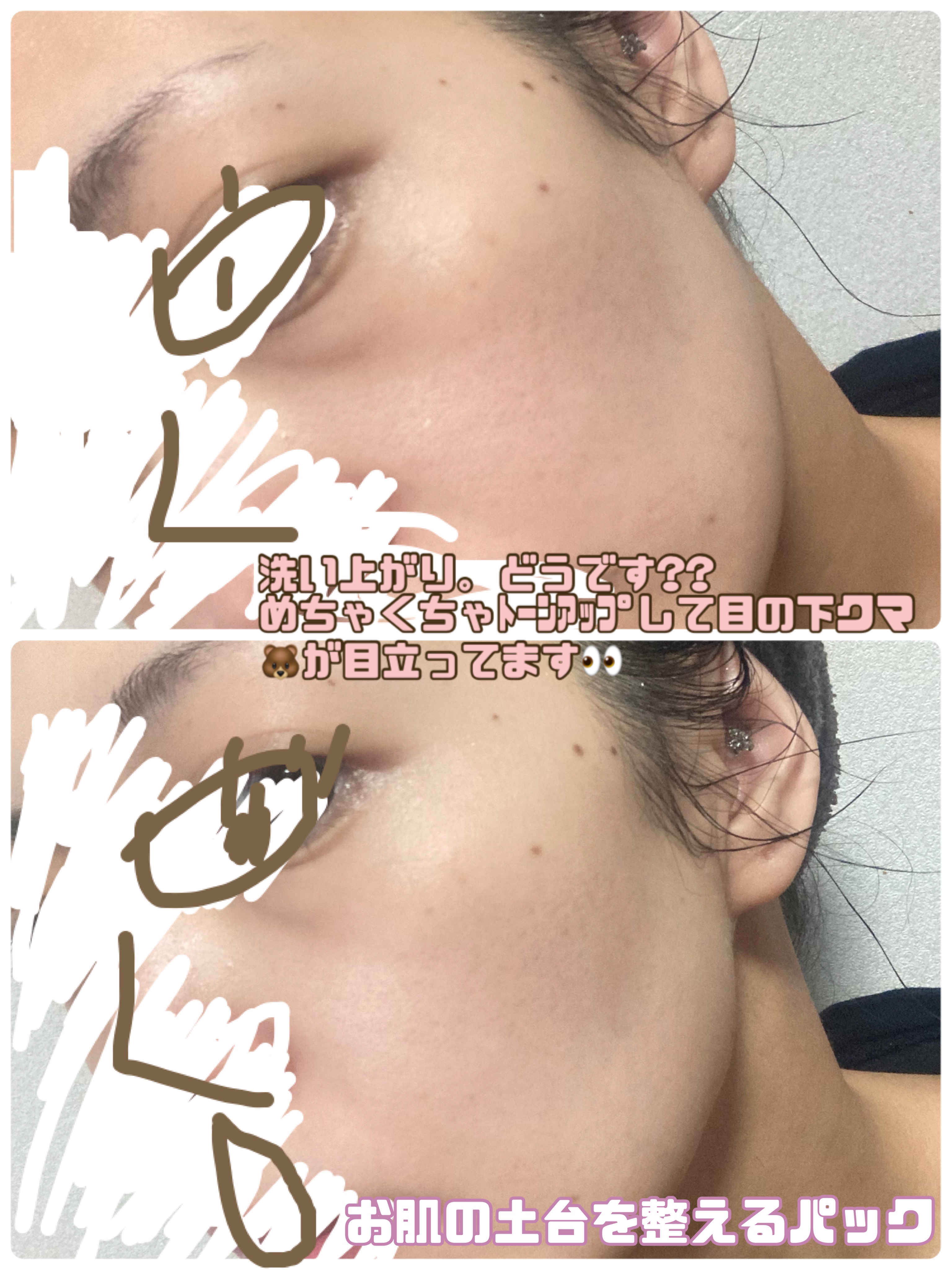 炭酸ジェルパック/NANO ACQUA/洗い流すパック・マスクを使ったクチコミ（3枚目）