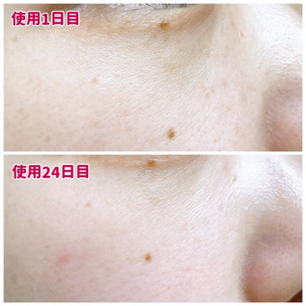 キューブマスク レチノール/ネイチャーリパブリック/シートマスク・パックを使ったクチコミ(5枚目)