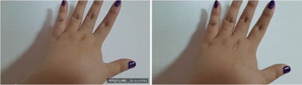 VEGAN TOLOGY NATURAL BHA BLACKHEAD OUTのクチコミ「こんにちは!
今日はなる肌管理ノウハウ共有をしようと思います~
肌は実は生まれ持ったものだ.....」(3枚目)