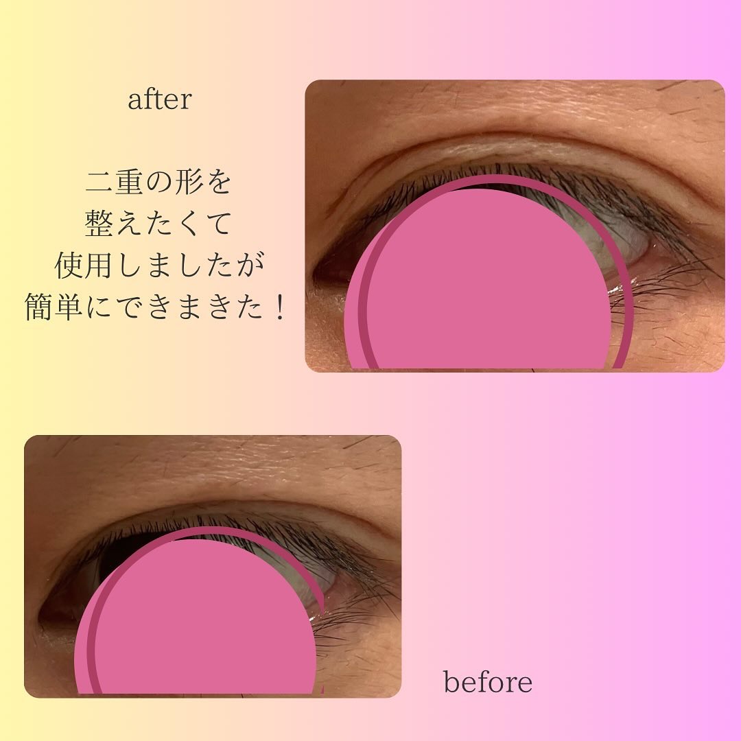 メザイク イージークリア 接着クリアタイプ/メザイク/二重まぶた用アイテムを使ったクチコミ（3枚目）