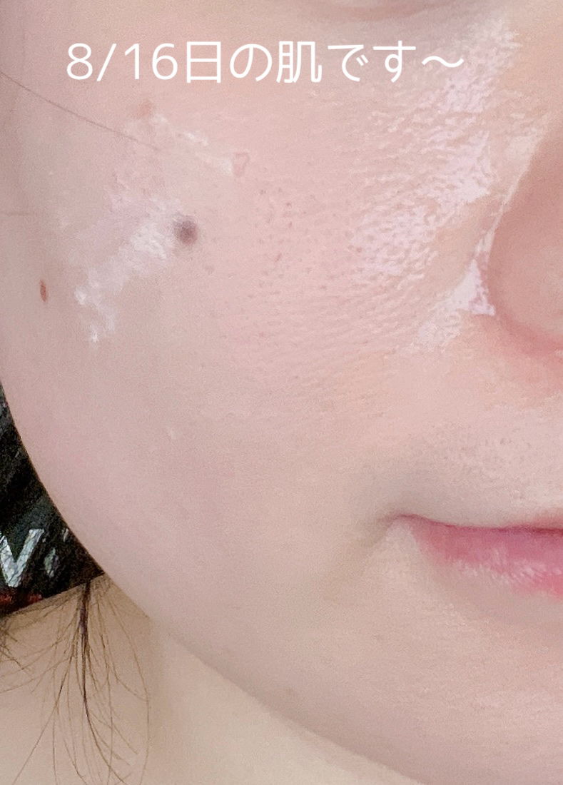 1番 塗るパントテン酸スージングクリーム/numbuzin/フェイスクリームを使ったクチコミ（3枚目）