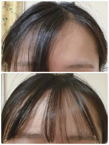 mod's hair スタイリッシュ モバイルヘアアイロン MHS-0840のクチコミ「💖風にも負けない前髪を!!💖
✂ーーーーーーーーーーーーーーーーーーーー
こんにち.....」(2枚目)