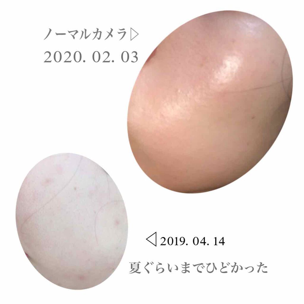 化粧水・敏感肌用・高保湿タイプ/無印良品/化粧水を使ったクチコミ（2枚目）