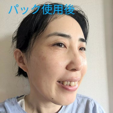 米発酵液配合  美容マスク  /やまとcosmetic/シートマスク・パックを使ったクチコミ（2枚目）