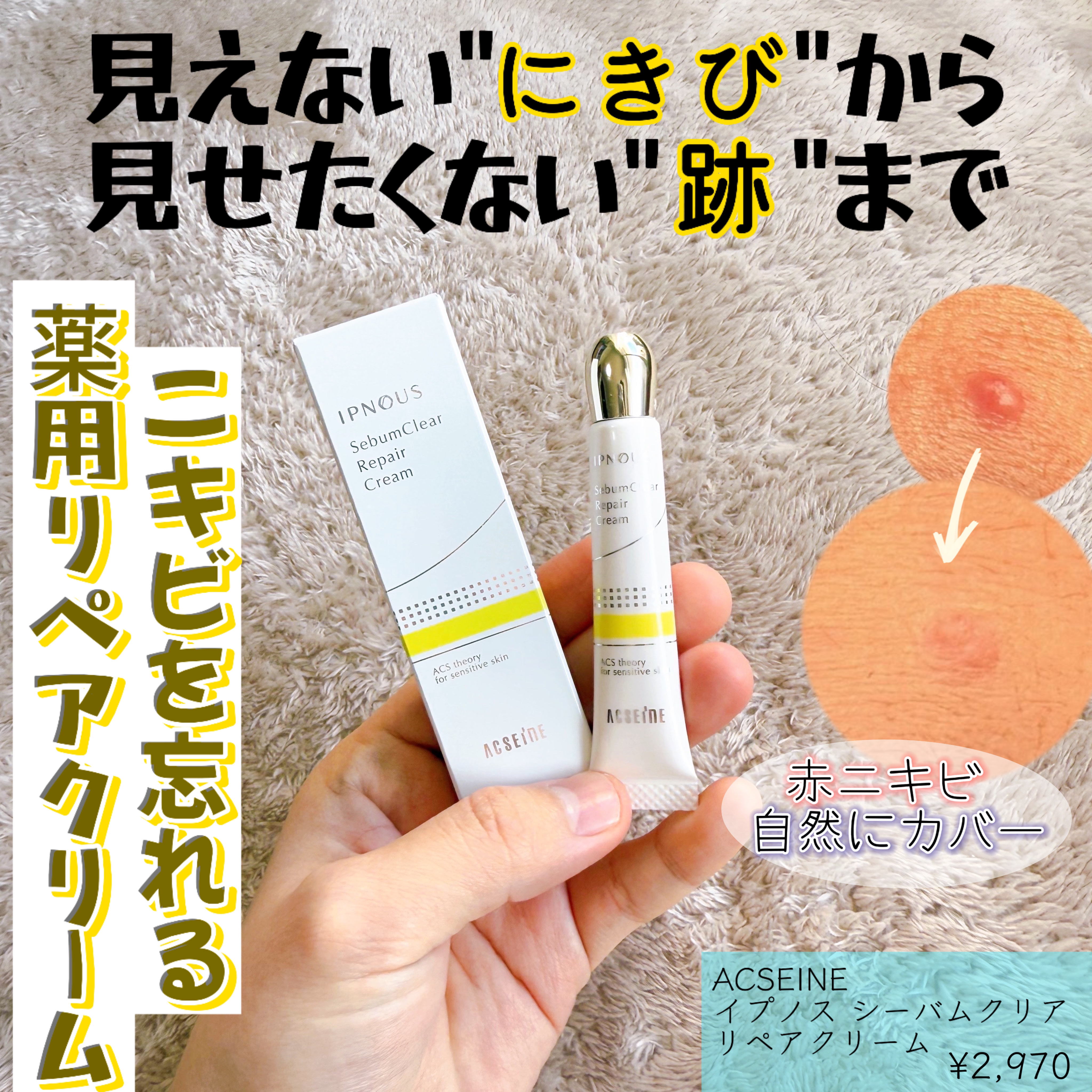 イプノス シーバムクリア リペアクリーム/ACSEINE/フェイスクリームを使ったクチコミ（1枚目）