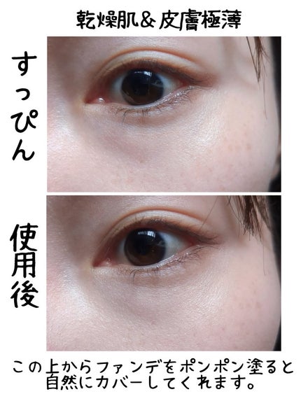 ピンポイントカラースナイパー/KATE/スティックコンシーラーを使ったクチコミ(2枚目)
