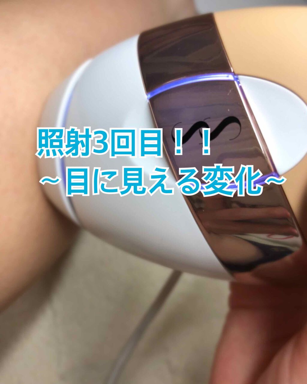 muchacha on LIPS 「すごい薄くなったと思いませんか?!勝手にぽろっと毛が出てきたり..」(1枚目)