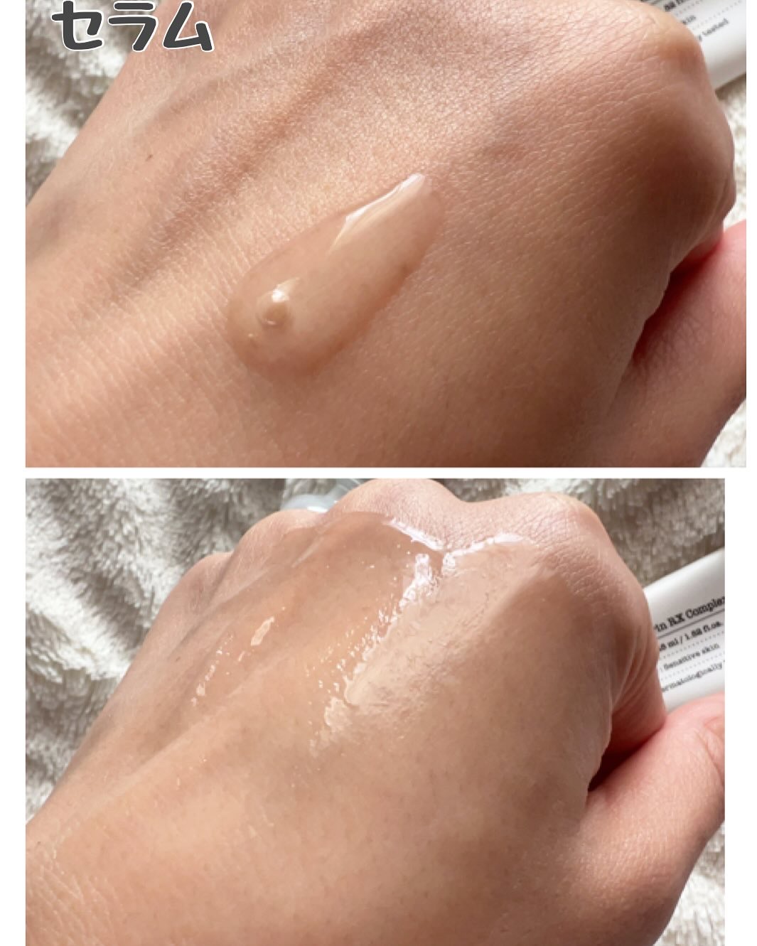 ノスカナイン トラブル セラム/FATION/美容液を使ったクチコミ（2枚目）