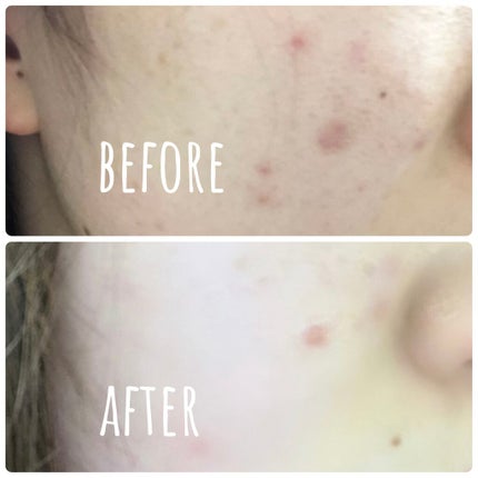 スイサイ ビューティクリア パウダーウォッシュ/スイサイ ビューティクリア/洗顔パウダーを使ったクチコミ(2枚目)