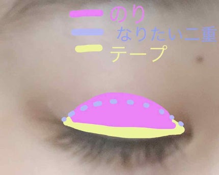 アヴァンセ ラッシュセラム EX(医薬部外品)/アヴァンセ/その他を使ったクチコミ(4枚目)