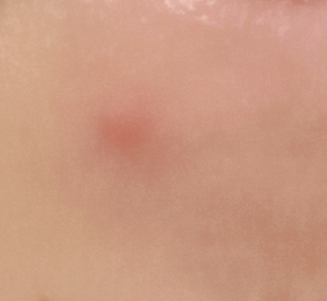 クリアローションI・II・III/BENEFIQUE/化粧水を使ったクチコミ（2枚目）