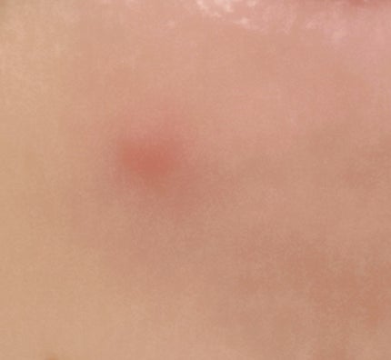 クリアローションI・II・III/BENEFIQUE/化粧水を使ったクチコミ(2枚目)